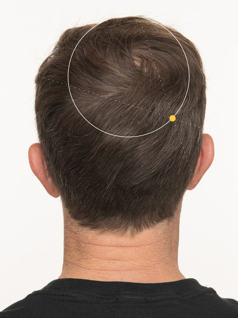 Mark 3 months into taking Nutrafol Men Hair Growth Nutraceutical. Results are from a clinical study and may vary