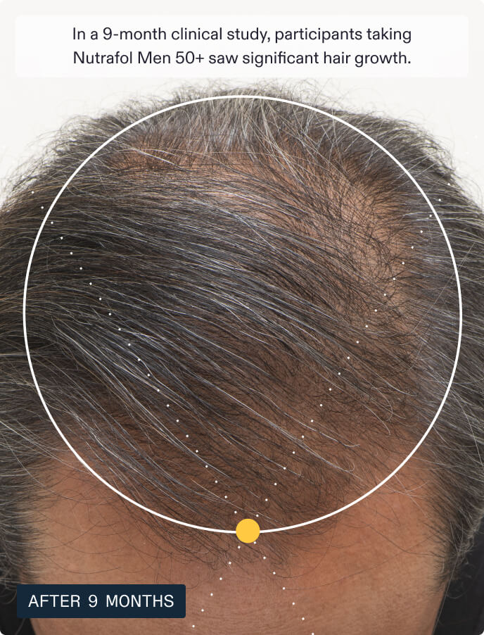 NUTRAFOL MEN 50+ — view 5