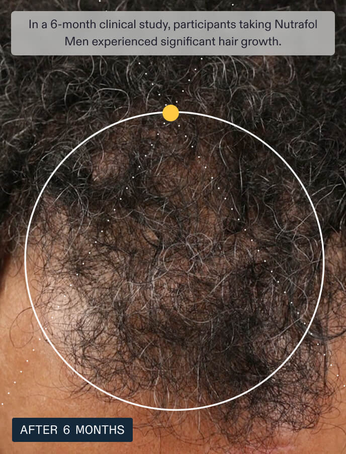 Nutrafol Men — view 5