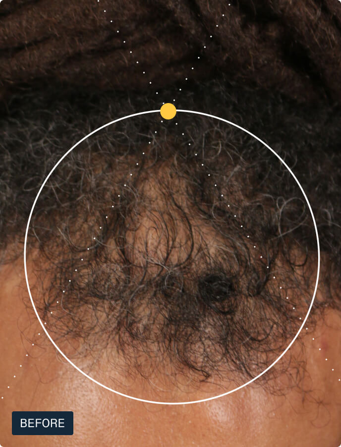 Nutrafol Men — view 4