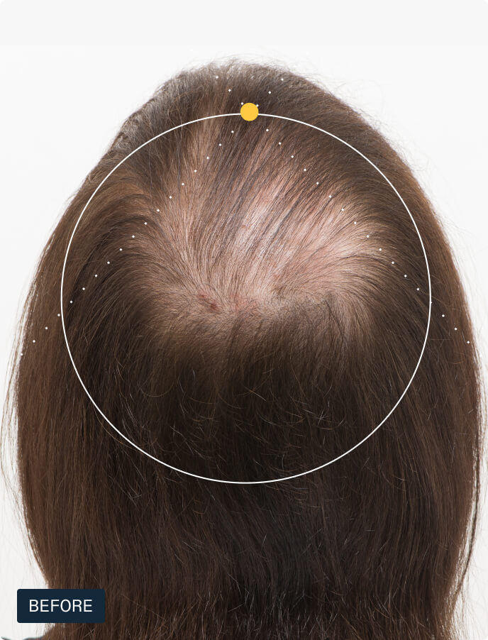 Hair Growth + Defense Duo — view 5