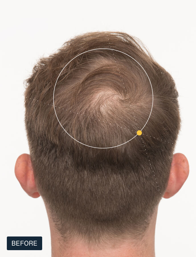 Hair Growth + Longevity Duo — view 5