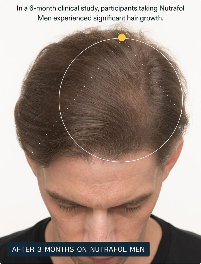 Hair Growth + Resilience Duo — view 6