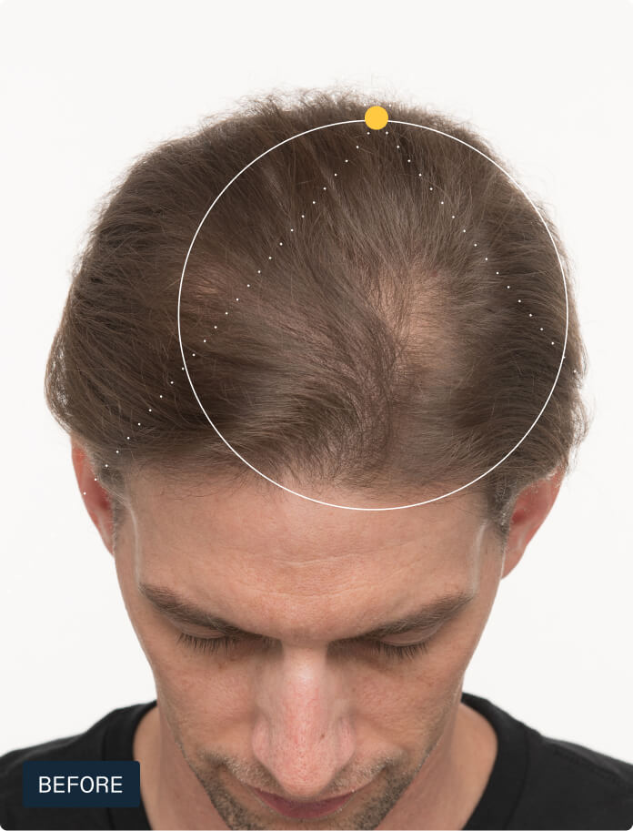 Hair Growth + Resilience Duo — view 5