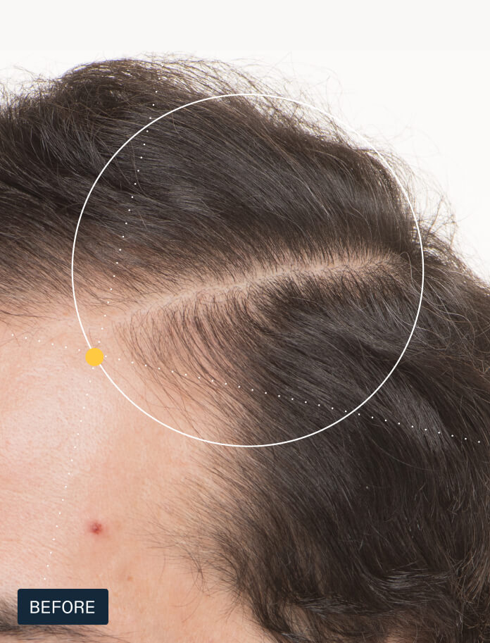 Hair Growth + Shield Duo — view 5