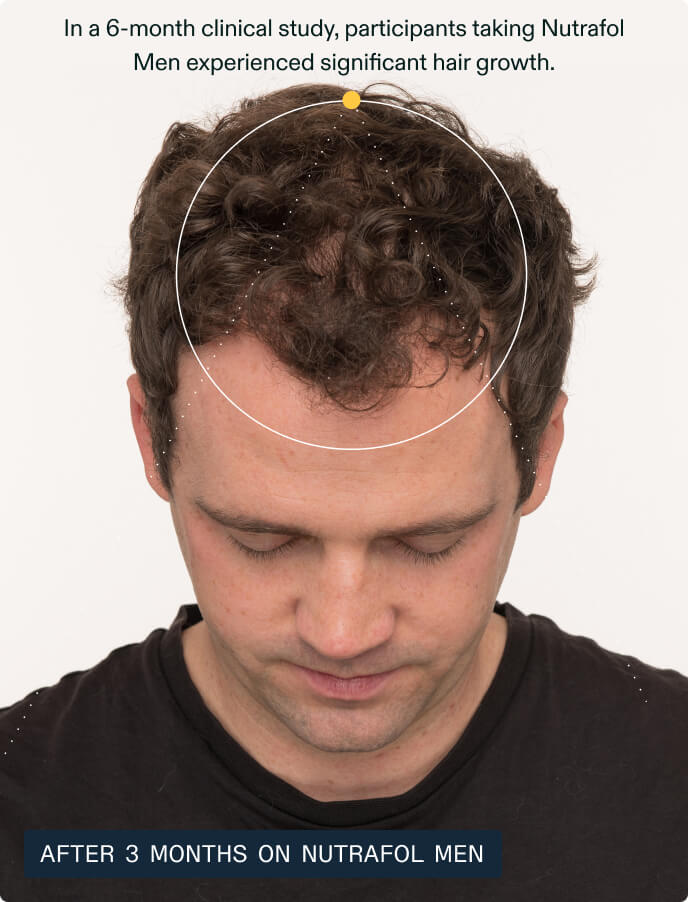 Hair Growth + Synbiosis Duo — view 6