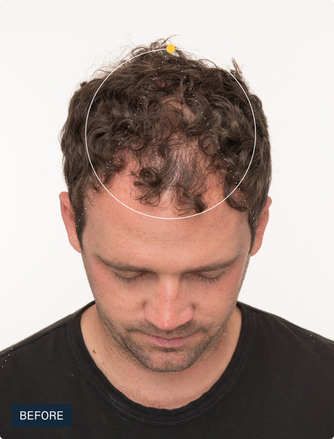 Hair Growth + Synbiosis Duo — view 5