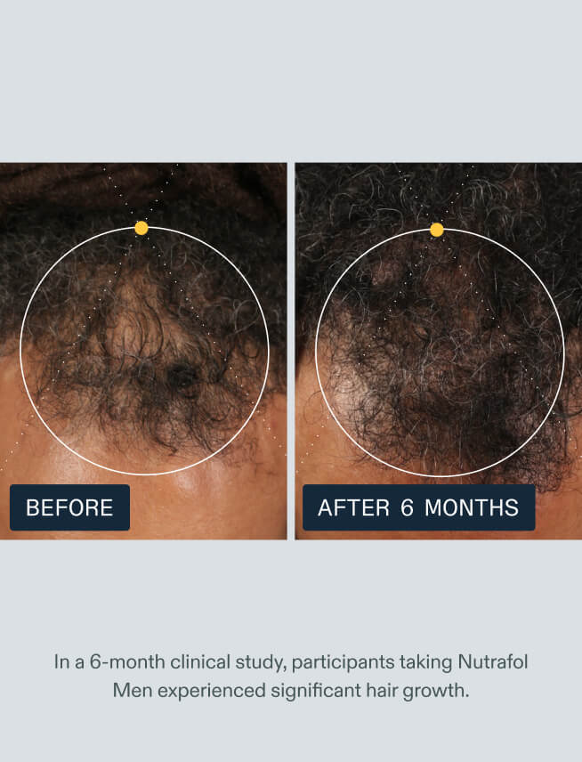 Nutrafol Men — view 10