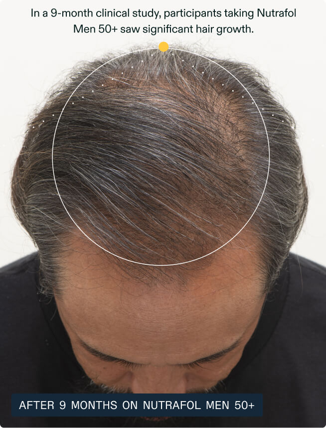 Hair Growth + Strength Duo — view 6