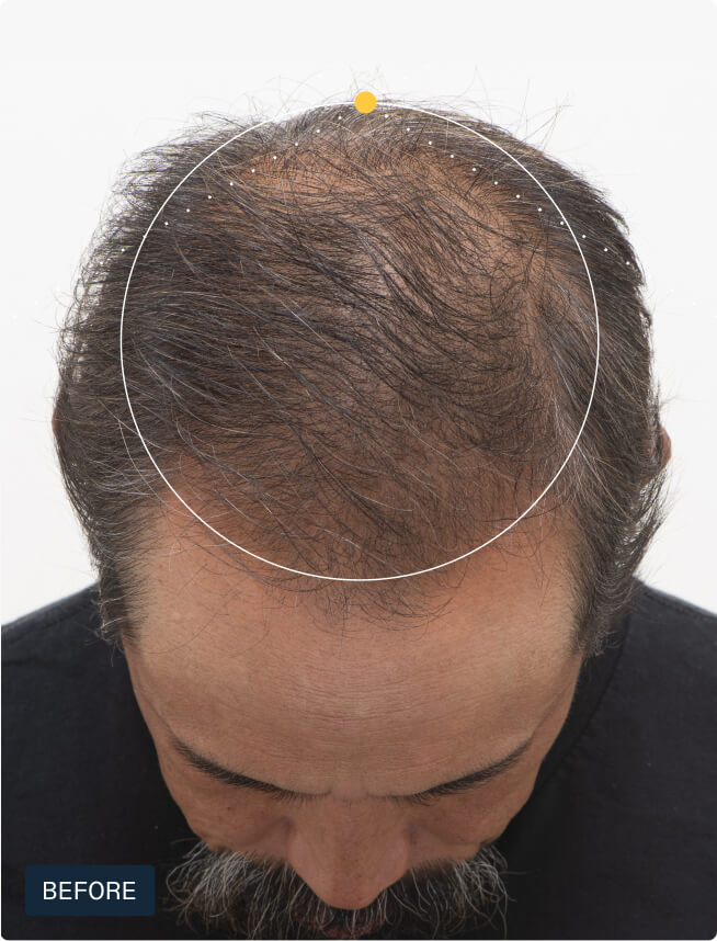 Hair Growth + Strength Duo — view 5