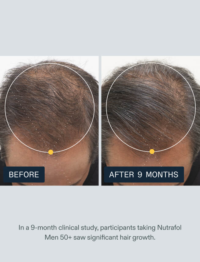 NUTRAFOL MEN 50+ — view 9