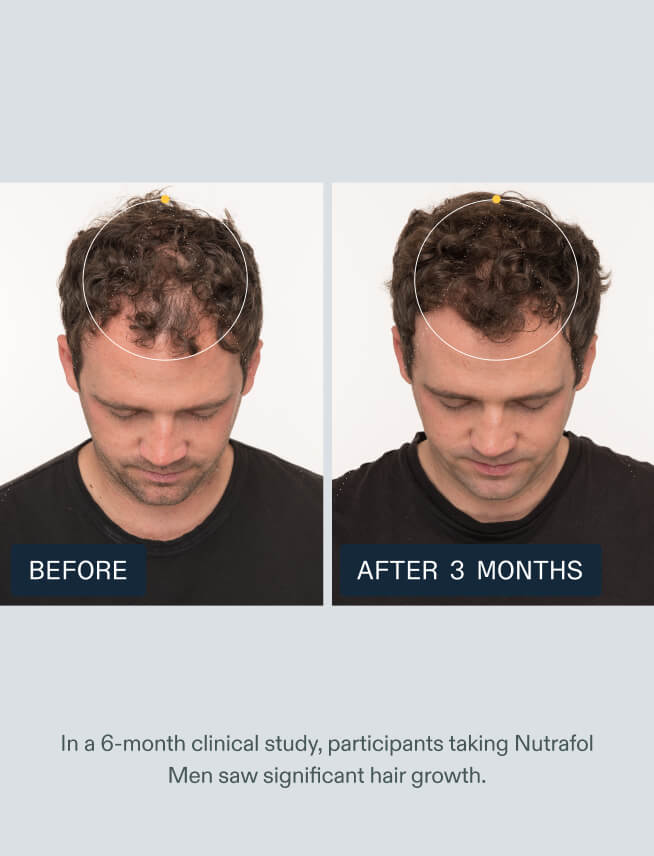 NUTRAFOL MEN WITH HAIR SERUM — view 12