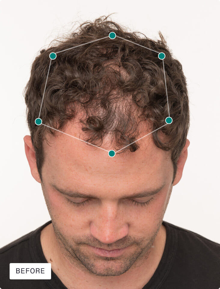 NUTRAFOL MEN WITH HAIR SERUM — view 7