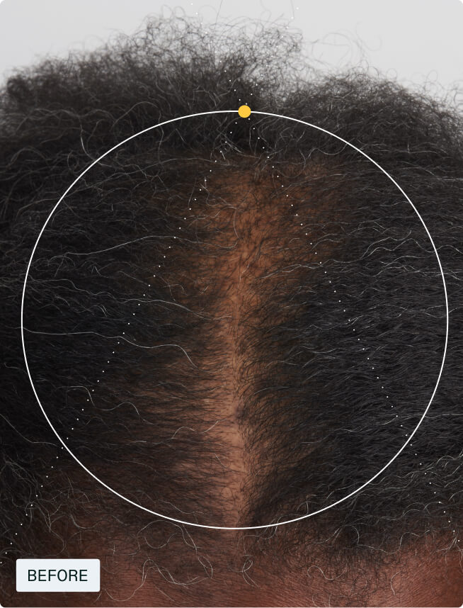Hair Growth + Resilience Duo — view 6