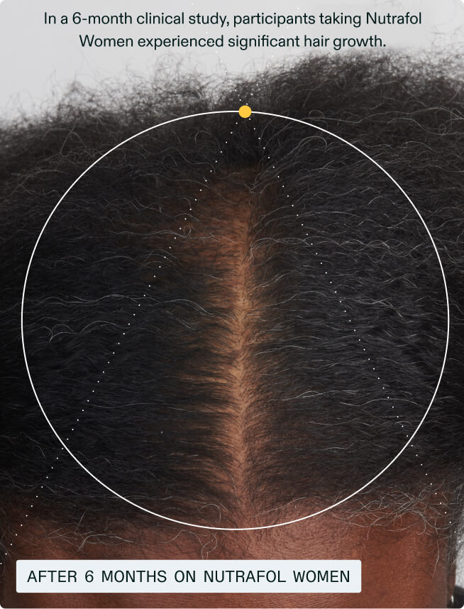 Hair Growth + Resilience Duo — view 7