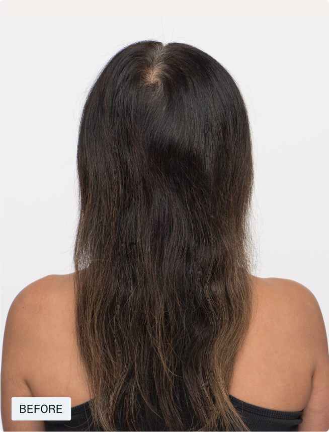 Hair Growth + Synbiosis Duo — view 6