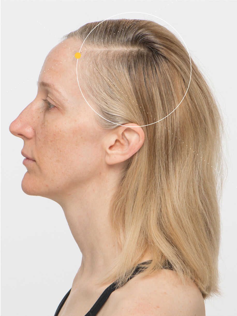 Tanya 3 months into taking Nutrafol Women’s Vegan Hair Growth Nutraceutical. Results are from a clinical study and may vary