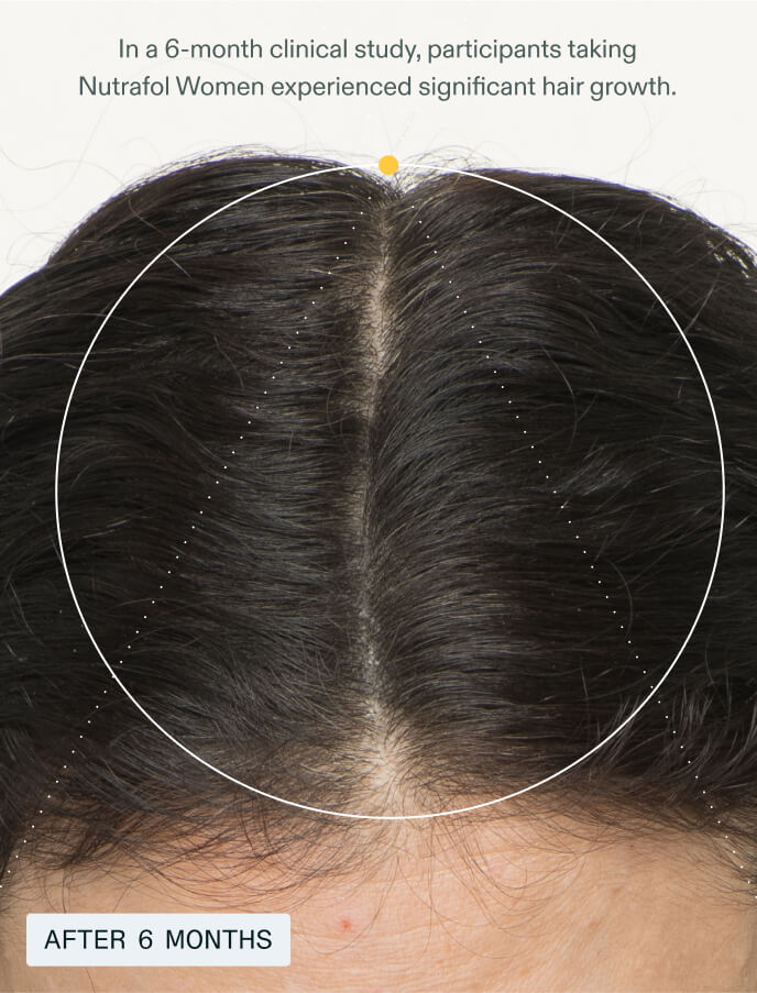 Women — view 6