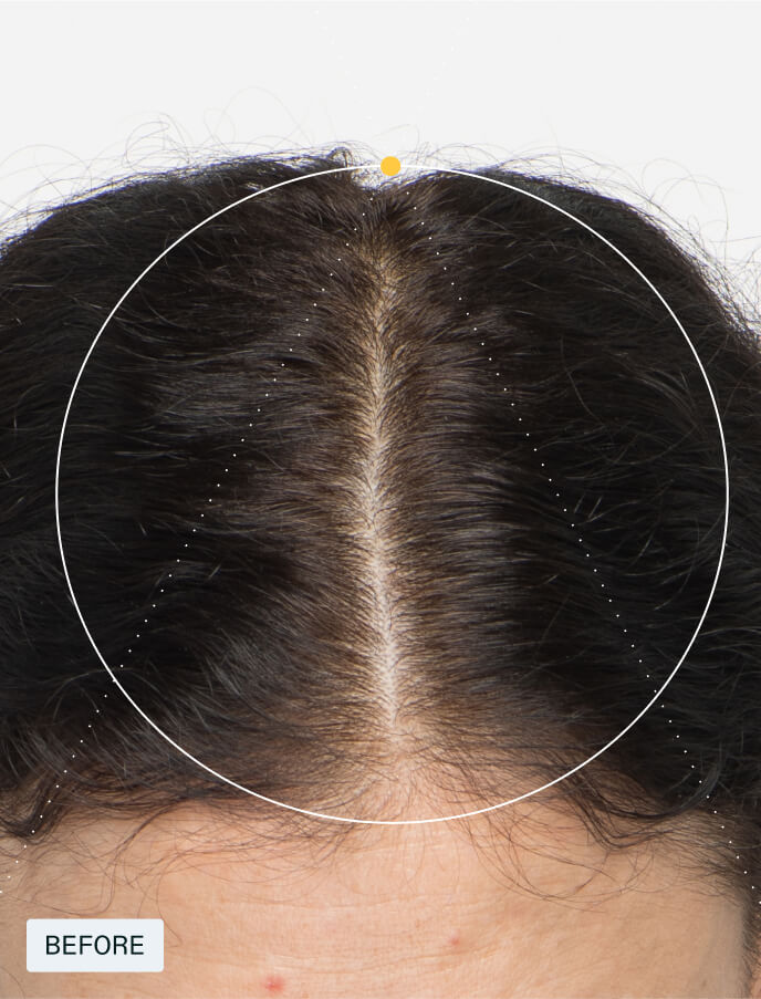 Women — view 5