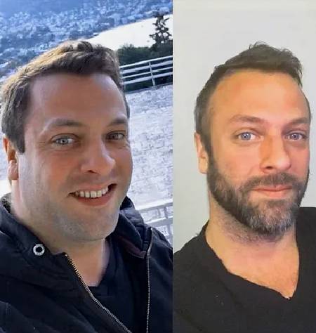 Johan — Zestal Trim results