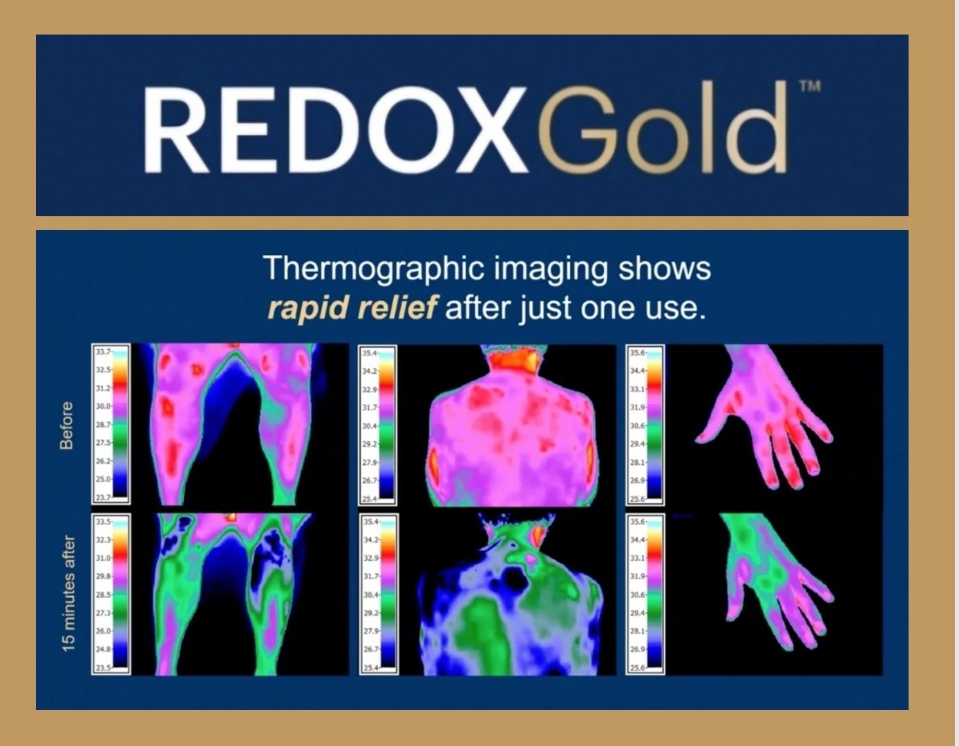 REDOXGold Thermography 