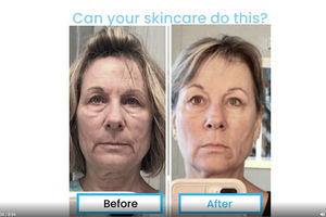 Neumi Skin Breakthrough Video