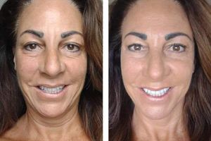 Skincare Breakthrough 