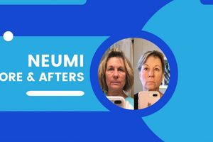Official Before & Afters
