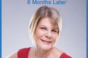 6 Months Later