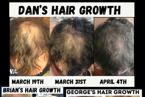 I’ve never taken a supplement before that has improved my hair!