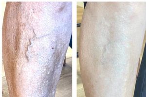 Look at her varicose veins! 