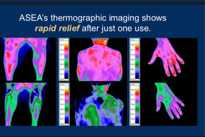 REDOX GOLD THERMOGRAPHIC RESULTS