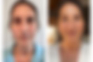 Irene Trivoulides: “I tried everything, not nothing seemed to work”