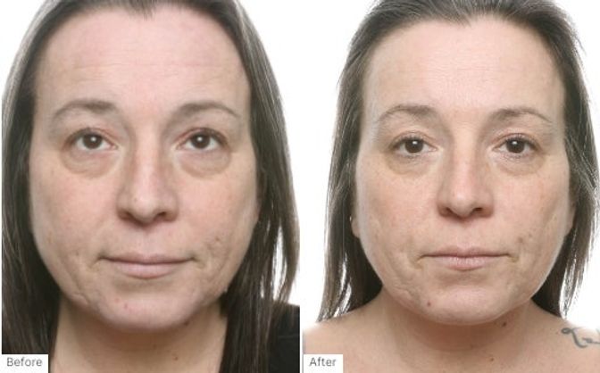 Transformation results - Hannah