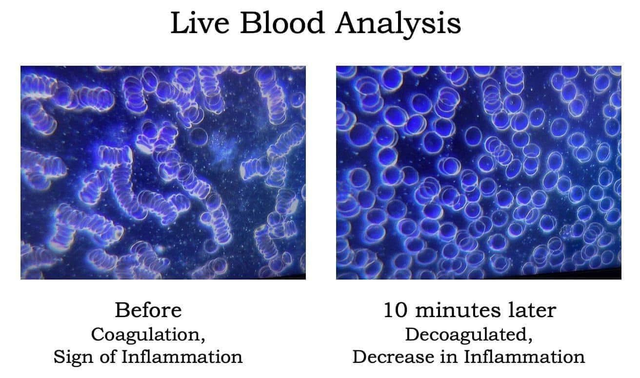 Blood Doesn’t Lie