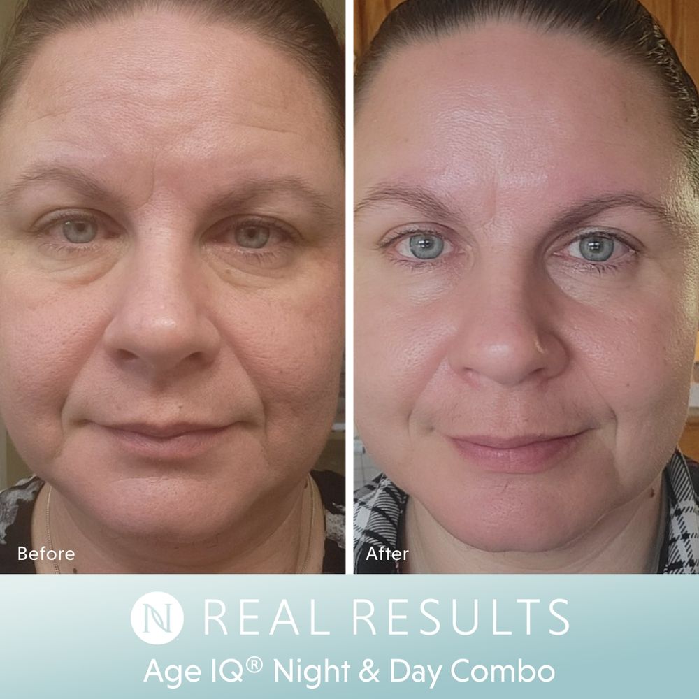 Age IQ® Day Cream