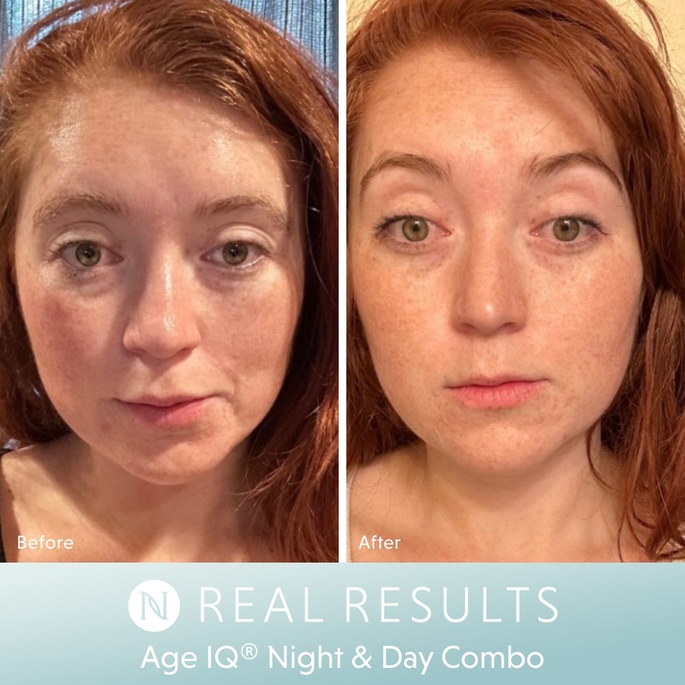 Age IQ® Night Cream