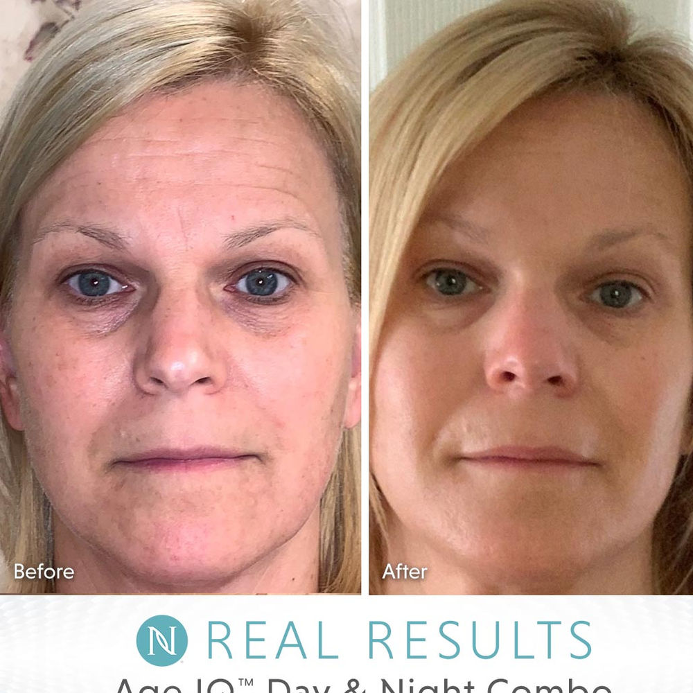 Age IQ® Night Cream