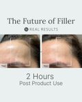 NEW! Neo-FILLER Lift + Fill Corrective Elixir