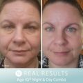 Age IQ® Day Cream
