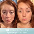 Age IQ® Night Cream