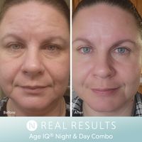 Age IQ® Day Cream
