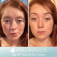 Age IQ® Night Cream