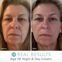 Age IQ® Night Cream