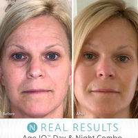 Age IQ® Night Cream