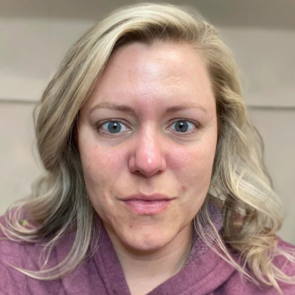 Before — Sarah M.