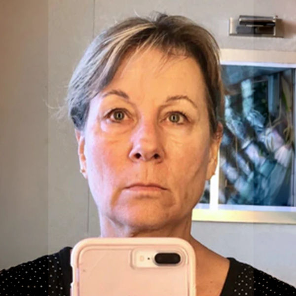 After — Lisa R.