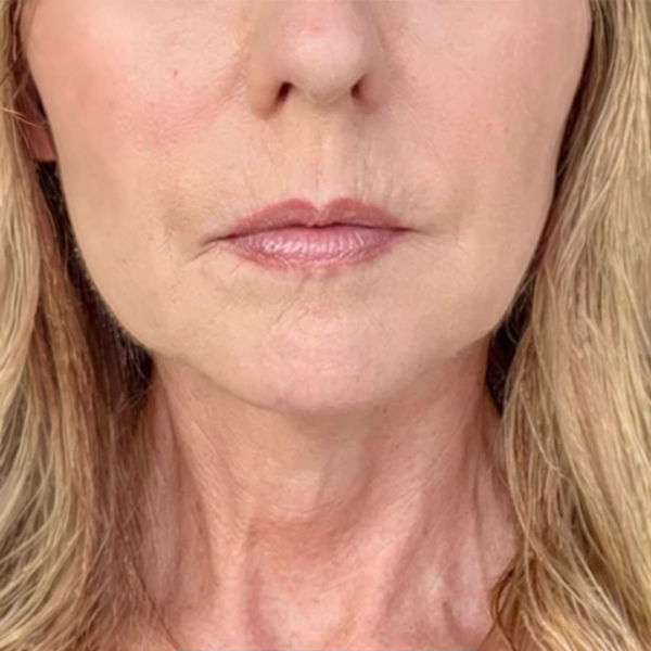 After — Amanda T.