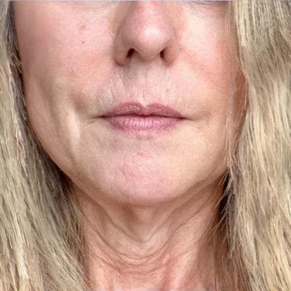 Before — Amanda T.