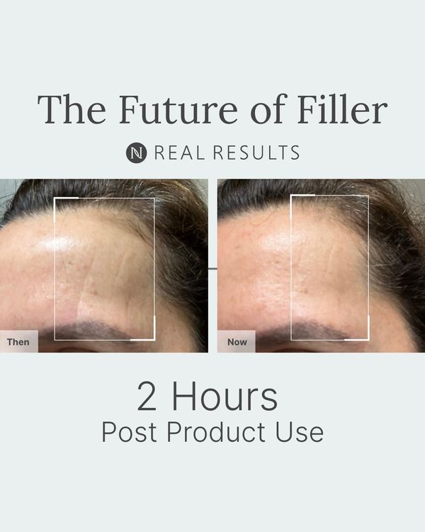 NEW! Neo-FILLER Lift + Fill Corrective Elixir